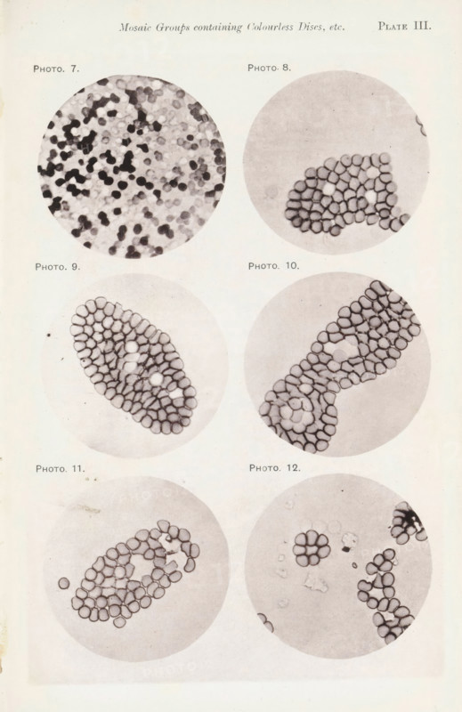 Six enlargements of blood cells, page, photomechanical print, number: 'Photo. 7., Photo. 12.', number: 'Pl. III.', photographer: Richard Norris, cliché maker: anonymous, c. 1872 - in or before 1882, paper, collotype, photoprint, height 213 mm x width 135 mm, Page opposite page 202., blood, A vertical page with six circular grayscale microscope images arranged in three rows, each circle containing clustered small round shapes with dark outlines and lighter centers; the top left circle shows a dense scatter of many small dark and light round shapes, the top right circle shows a compact cluster of outlined round shapes against a lighter background, the middle left circle shows an elongated cluster of outlined round shapes with a few lighter interior spots, the middle right circle shows a longer irregular chain of outlined round shapes with a central lighter ring, the bottom left circle shows a loose curved ring of outlined round shapes with a few isolated discs nearby, and the bottom righ...