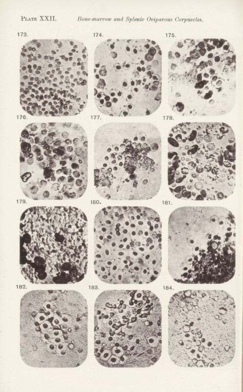 Twelve enlargements of bone marrow, page, photomechanical print, number: 'Pl. XXII.', number: 'Photo. 173., Photo. 184.', photographer: Richard Norris, cliché maker: anonymous, c. 1872 - in or before 1882, paper, collotype, photoprint, height 213 mm x width 135 mm, Page opposite page 229., blood, A vertical sheet showing a grid of rounded square photographic panels arranged in three columns and five rows, each panel containing close-up grayscale images of irregular circular and oval shapes with varying textures and densities, some panels showing dense clusters of dark round forms against lighter backgrounds while others show more scattered, faintly shaded circles and amorphous darker blotches, with visible grain and spotty staining across many panels and margins of the sheet showing light paper texture.