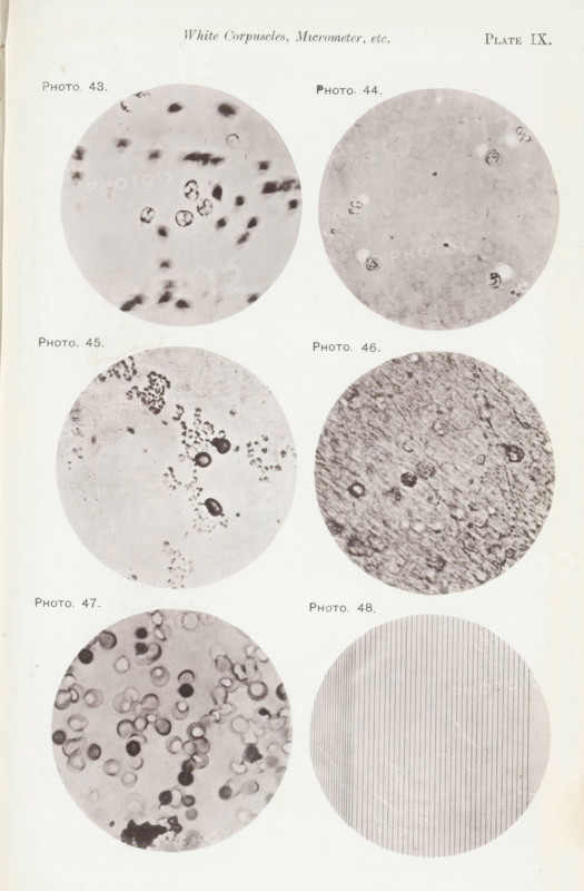 Five enlargements of blood and a micrometer, page, photomechanical print, number: 'Pl. IX.', number: 'Photo. 43., Photo. 48.', photographer: Richard Norris, clichémaker: anonymous, c. 1872 - in or before 1882, paper, collotype, light print, height 213 mm x width 135 mm, Page opposite page 208., blood, A vertical page showing a grid of round photographic circles arranged in two columns and multiple rows, each circle containing different close-up grayscale microscopic or textured images; the top row has two circles with faint cellular shapes and irregular dark spots, the second row shows a circle with scattered small clustered particles opposite a circle with a mottled fibrous texture and a few round darker formations, the third row presents a circle filled with many round ring-like shapes and varied shading opposite a circle composed of fine evenly spaced vertical lines, all circles set against a light background.