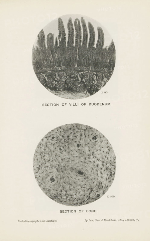 Section of villi of duodenum, Section of bone, page, photomechanical print, inscription: 'x 50. x 100.', printmaker: Bale, Sons & Danielson Ltd., London, c. 1889 - in or before 1899, photographer, paper, collotype, photoprint, height 225 mm x width 155 mm, Prints opposite page 160., bones in general (human body), intestines, A vertical cream-colored page shows two circular grayscale microscope images aligned one above the other, each surrounded by blank margin; the top circle contains a textured pattern with elongated fingerlike projections extending upward from a dense basal layer and a mottled lower region, while the bottom circle displays a concentric, ringed pattern with small dark spots scattered throughout and subtle radial striations.