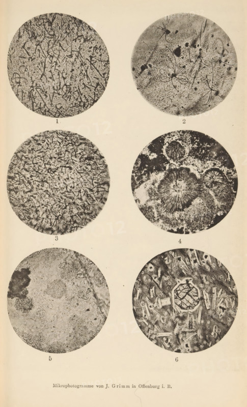Six microscopic enlargements of minerals, page, photomechanical print, Image 1 is micaceous lime in obsidian, 2 is trichite in obidian, 3 is microlite and micaceous lime in obsidian, 4 is obsidian, 5 is cummulite and 6 is augite., number: '1, 6', number: 'Tafel II', photographer: Emil Cohen, Greifswald, cliché maker: J. Grimm, Offenburg, c. 1880 - in or before 1885, Baden-Württemberg, Mecklenburg-Vorpommern, paper, collotype, photoprint, height 233 mm x width 149 mm, minerals and metals, A vertical page shows six circular grayscale microscopic images arranged in three rows and two columns against a light background, each circle containing different textured patterns; the top left circle displays a dense tangled network of thin dark lines over a mottled lighter ground, the top right circle contains several elongated curved filament-like shapes and small dark irregular spots on a grainy background, the middle left circle shows many short rod-like and angular fragments scattered over a mo...