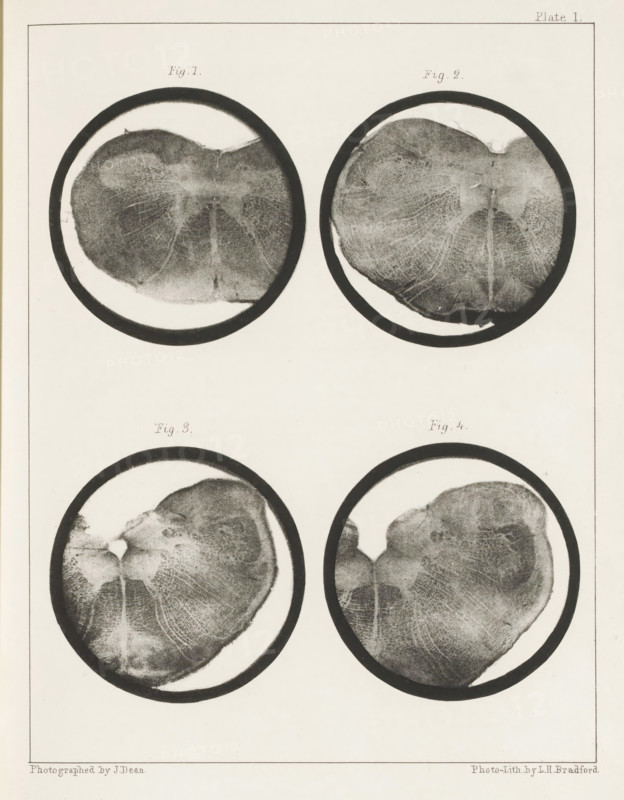 Four details of a medulla oblongata of a sheep, page, photomechanical print, number: 'Plate I. Fig. 1. Fig 2. Fig. 3. Fig. 4.', photographer: John Dean, printmaker: Bradford & Co, LH, c. 1854 - in or before 1864, paper, photolithography, height 301 mm x width 230 mm, brains, A vertical page with four circular black-bordered images arranged in a two-by-two grid, each circle containing a grayscale, textured, roughly heart-shaped form with radiating fine lines and mottled shading, darker outer rims, and lighter central areas; the top pair sits higher on the page with small spaces between them and the bottom pair, while the overall page has a thin rectangular border and pale background.