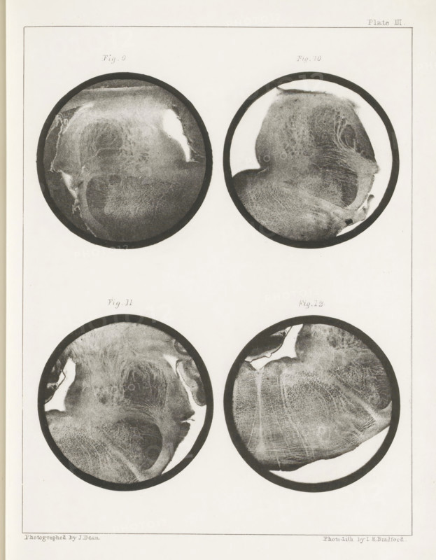 Four details of a sheep medulla oblongata, page, photomechanical print, number: 'Plate III. Fig. 9. Fig 10. Fig. 11. Fig. 12.', photographer: John Dean, printmaker: Bradford & Co, LH, c. 1854 - in or before 1864, paper, photolithography, height 301 mm x width 230 mm, brains, A vertical sheet with a thin rectangular border contains four circular grayscale images arranged in two rows, each circle bordered by a dark ring; the images show textured, irregular organic patterns with light and dark mottling and smooth transitions, including lighter crescent-shaped areas near the edges and varied grainy shading across each circle, with subtle curved striations and patches of smoother highlights; the top two circles sit near the upper half of the sheet and the bottom two near the middle, leaving margins of blank pale paper around them.