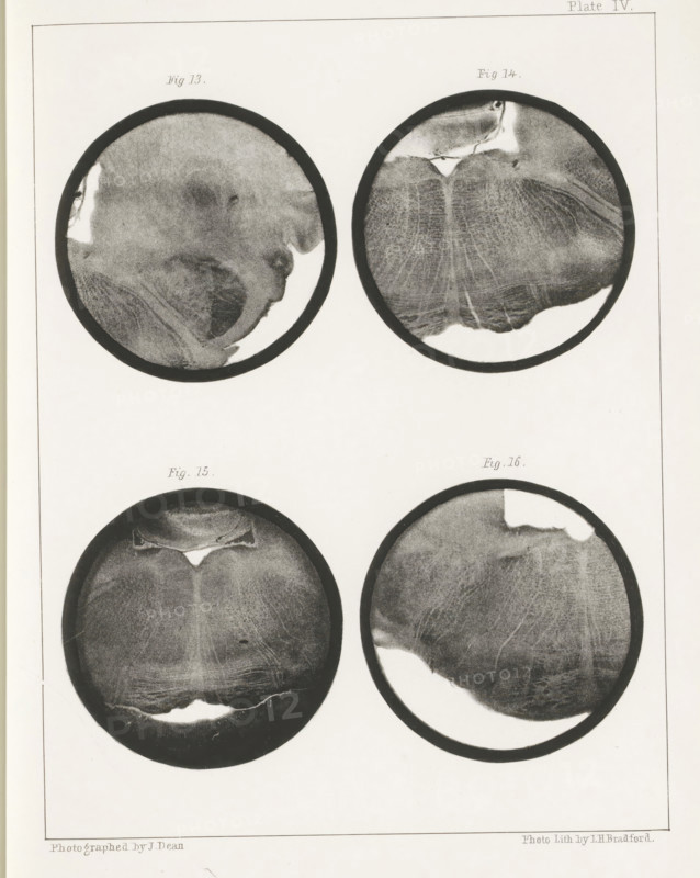 Four details of a sheep medulla oblongata, page, photomechanical print, number: 'Plate IV. Fig. 13. Fig 14. Fig. 15. Fig. 16.', photographer: John Dean, printmaker: Bradford & Co, LH, c. 1854 - in or before 1864, paper, photolithography, height 301 mm x width 230 mm, brains, A pale rectangular page contains four circular grayscale images arranged in a two-by-two grid within a thin bordered frame, each circle surrounded by a dark rim and showing varied organic textures and shading; the top left circle displays a mottled surface with lighter patches and a curved darker area along one edge, the top right circle shows a textured pattern of fine lines radiating from a central lighter region and a bright irregular spot near its rim, the bottom left circle presents a symmetrical darker center with subtle striations and a bright irregular crescent near its lower edge, and the bottom right circle features a large lighter curved area against a textured darker background with subtle linear markin...