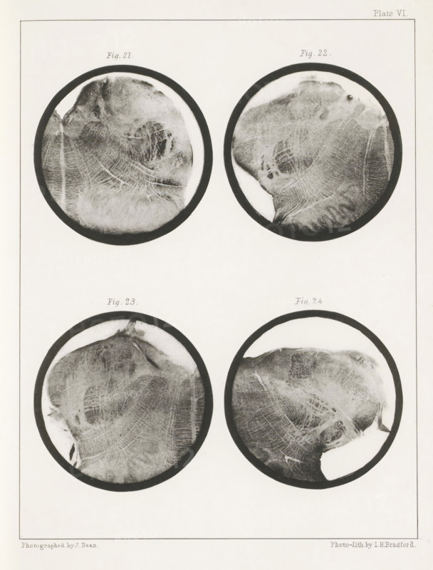 Four details of a human medulla oblongata, page, photomechanical print, number: 'Plate VI. Fig. 21. Fig 22. Fig. 23. Fig. 24.', photographer: John Dean, printmaker: Bradford & Co, LH, c. 1854 - in or before 1864, paper, photolithography, height 301 mm x width 230 mm, brains, A pale background shows four circular grayscale images arranged in a grid, each circle bordered by a dark rim and containing textured, organic-looking patterns resembling layered ridges and smudged areas; the top pair of circles sit near the upper edge while the bottom pair are lower with ample blank space beneath, and faint rectangular framing lines surround the whole composition.