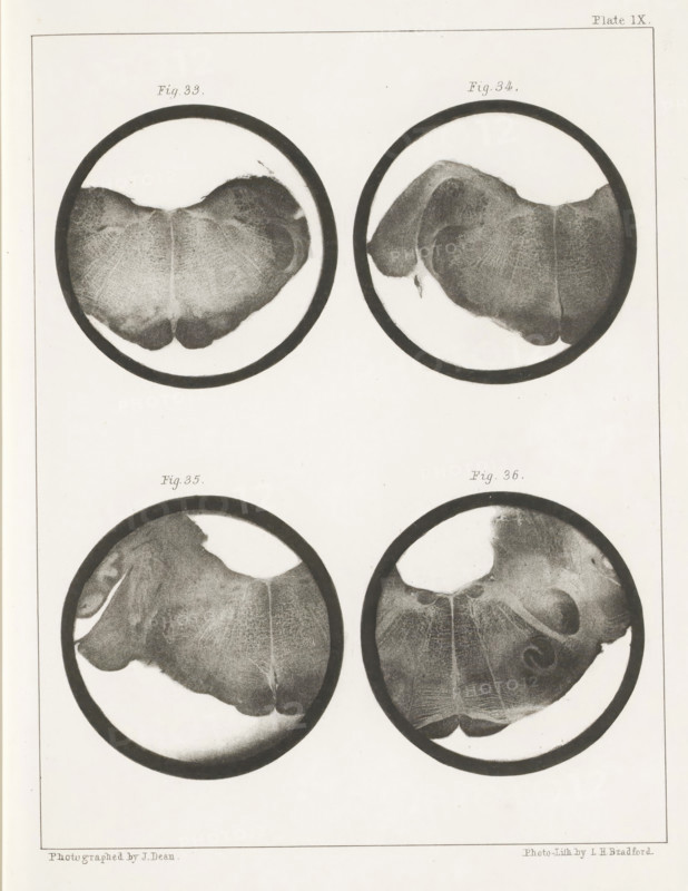 Four details of a human medulla oblongata, page, photomechanical print, number: 'Plate IX. Fig. 33. Fig 34. Fig. 35. Fig. 36.', photographer: John Dean, printmaker: Bradford & Co, LH, c. 1854 - in or before 1864, paper, photolithography, height 301 mm x width 230 mm, brains, A vertical sheet shows four circular monochrome images arranged in a grid, each containing a rounded organic shape with textured surfaces and subtle shading variations; the top two circles display similar wide, lobed forms with fine radiating striations and darker outer rims, while the bottom two circles show comparable shapes with irregular edges, lighter central areas, and darker perimeters, all set against a pale background with a thin rectangular border around the page.