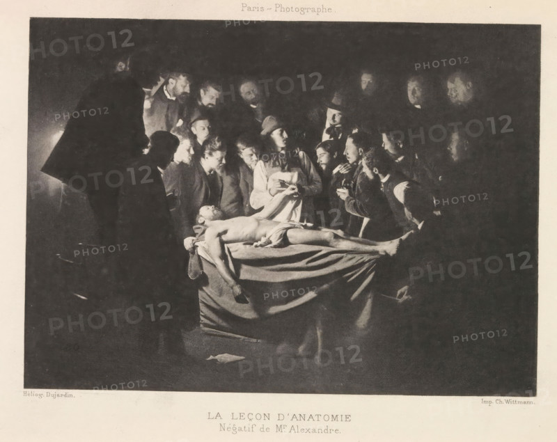 Anatomic lesson, Le leçon d'anatomie, page, photomechanical print, photographer: Alexandre, France, cliché maker: Dujardin, printer (person): Charles Wittmann, c. 1884 - in or before 1894, Alexandre, Dujardin, Charles Wittmann, photographer, cliché maker, printer (person), paper, photoaquatint, height 121 mm x width 167 mm, anatomical specimen, A dimly lit scene shows a group of men gathered closely around a central table where a nude male figure lies on his back with one arm hanging off the table and a cloth draped low over his hips, the men leaning in with focused expressions and varied headwear and clothing, some holding small objects and one appearing to gesture toward the body, the surrounding space receding into deep shadow with faces and hands illuminated by a single light source above the table.