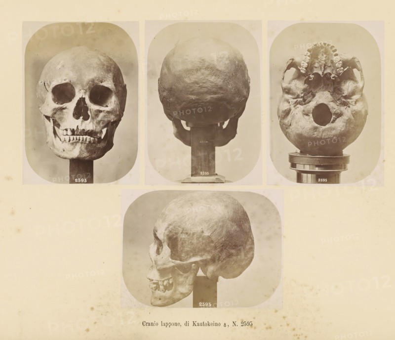 Four images of a Sami male skull, Cranio lappone, di Kautokeino ?, No. 2595, page, Top left a front view, top center a rear view, top right a view of the underside, bottom a side view., number: '2595', number: 'Tavola XXXVI.', photographer: Paolo Mantegazza, Scandinavia, photographer: Carlo Pietro Stefano Sommier, c. 1870 - in or before 1880, paper, albumen print, height 254 mm x width 340 mm, Photo in photo section at the back., (human) skull, A sepia-toned sheet shows five photographic views of a human skull mounted on stands, arranged with three images across the top and two larger images below; the top left shows a frontal view of the skull with empty eye sockets and visible upper and lower teeth, the top center shows the rear of the skull with the rounded occipital surface, and the top right shows the skull viewed from below with the palate and tooth sockets visible around a large central opening; the lower left image shows a profile view of the skull angled slightly forward, and ...