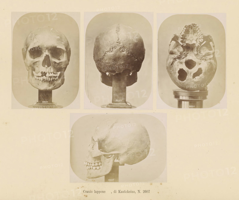Four images of a Sami skull, Cranio lappone, di Kautokeino, No. 2607, page, Top left a front view, top center a rear view, top right a view of the underside, bottom a side view., number: '2607', number: 'Tavola XLI.', photographer: Paolo Mantegazza, Scandinavia, photographer: Carlo Pietro Stefano Sommier, c. 1870 - in or before 1880, paper, albumen print, height 254 mm x width 340 mm, Photos in photo section at the back., (human) skull, Three photographic prints of a human skull mounted on stands are arranged across the top of the page and one larger photographic print of the same skull in profile is centered below them, all images shown on a pale background. The left top photograph shows a frontal view of the skull with visible eye sockets, nasal opening, and a row of teeth resting on a rectangular stand. The center top photograph shows the rear of the skull with a visible jagged suture line running vertically and horizontally and the skull mounted on a similar stand. The right top ph...