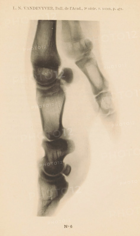 X-ray of a pig's leg, page, photomechanical print, number: 'No 6', photographer: Guequier, Ghent, maker: E. Castelein, Brussels, c. 1891 - in or before 1896, Guequier, E. Castelein, photographer, paper, collotype, photoprint, height 163 mm x width 80 mm, Print on fifth unnumbered page after page 470., X-ray examination, A vertical grayscale image of a close-up radiographic view of toe bones on a light background, showing multiple phalanges and joint spaces with varying shades of gray and darker rounded bone ends; the bones appear aligned in two adjacent columns with one toe slightly angled, and soft-tissue shadows surrounding the bones.