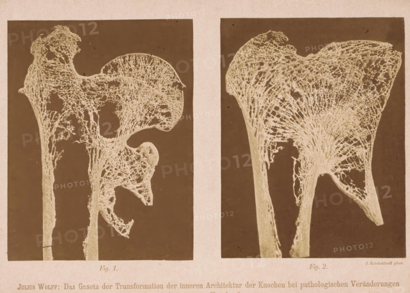 Twice a detail of the structure of the interior of a bone, Julius Wolff: The Gesetz der Transformation der inneren Architektur der Knochen bei pathologischen Veränderungen der äusseren Knochenform, photograph, page, number: 'Taf. I. Fig. 1. Fig. 2.', photographer: Julius Kricheldorff, c. 1874 - c. 1884, paper, albumen print, height 187 mm x width 268 mm, Photos at the back of the book., bones in general (human body), A sepia-toned image divided into two vertical panels shows detailed pale lattice-like structures against darker rectangular backgrounds, each resembling porous, branching organic forms with thin elongated stems leading to broader, irregularly shaped tops; the left panel displays a structure with a rounded upper section and a hooked protrusion, while the right panel shows a larger fan-shaped top with radiating filamentous networks, both set within a lighter border and framed by a narrow vertical strip separating the panels.