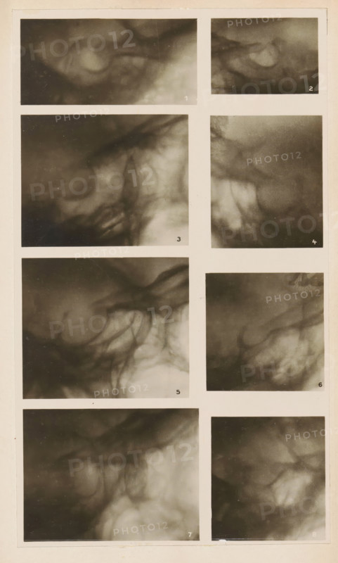Eight x-rays, photograph, page, name: 'Dr. Alban Köhler', c. 1904 - in or before 1909, photographer, paper, gelatin silver print, developing gelatin silver print, height 188 mm x width 111 mm, Photo in section at the back of the book., X-ray examination, A tall, narrow sheet divided into a grid of rectangular panels filled with soft-focus, monochrome cloudlike textures and swirling shadow patterns, each panel showing blurred organic shapes with gradients from dark to light and wispy, veinlike strands running through them; the sheet has pale borders between panels and a slightly aged, off-white outer margin with small scratches and faint discoloration.