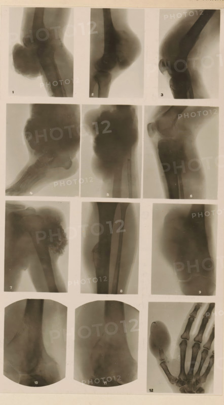 Twelve x-rays of different joints, photograph, page, name: 'Dr. Hauchamps.', c. 1904 - in or before 1909, photographer, paper, gelatin silver print, developing gelatin silver print, height 194 mm x width 106 mm, Photo in section at the back of the book., X-ray examination, (human) skeleton, A vertical montage of grayscale radiographic images arranged in a grid, showing various limb and joint views. The top row contains three narrow vertical X-ray panels depicting rounded bone structures and joint contours. The second row has three larger vertical panels showing bone ends and surrounding soft-tissue silhouettes in different orientations. The third row includes three images with irregular bone masses and elongated shaft views. The bottom rows contain two rounded-corner vertical images with diffuse bone and soft-tissue shading and a final panel showing a hand with visible metacarpal and phalangeal bones and a rounded detached structure nearby. The entire sheet has a pale border and small ...