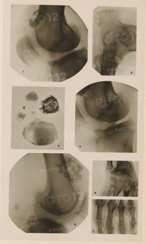Seven x-rays of various joints and substances, photograph, page, name: 'Dr. Lejeune.', c. 1904 - in or before 1909, photographer, paper, gelatin silver print, developing gelatin silver print, height 182 mm x width 104 mm, Photo in section at the back of the book., X-ray examination, (human) skeleton, A pale background holds a vertical arrangement of photographic panels showing monochrome medical images and tissue samples; the top left panel displays a rounded dark form with softer gray surrounding shapes, while the top right panel shows a vertical elongated structure with layered gray textures. The upper middle left panel contains several irregularly shaped small dark masses and a larger mottled specimen against a light field, and the upper middle right panel features a rounded dark mass adjacent to a lighter curved area. The lower left large panel shows a smooth rounded silhouette with soft shading and a lighter surrounding border, and the lower right column contains a square panel wi...