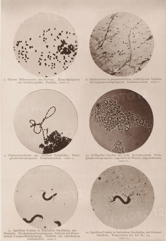 Six microscope images of bacteria and eubacteria, page, photomechanical print, number: 'Tafel II.', inscription: '7. Gross Micrococci from Faeces. Klatschpräparat von Gelatineplatte. Fuchsin. 1000:1. 8. Diplococci in pneumonischem, rostfarbenen Sputum. Deckglassrockenpräparat. Gentianaviolett. 1000:1. 9. Diplococcenkette aus cariöser Zahnhöhle. Deckglassrockenpräparat. Gentianaviolett. 1000:1. 10. Gelbgrüne Sarcine from Luft. Gelatin culture. Deckglasrockenpräparat, ungeefärbt in Wasser eingeschlossen. 1000:1. 11. Spirillum Undula in faulendem Strohinfus, mit Geisseln. Deckglassrockenpräparat. Gebeizt mit Ferrotannat-Campecheholzlösung. Gefärbt mit alkalischem Anilinfuchsin. 1000:1. 12. Spirillum Undula in faulendem Strohinfus, mit Gessel-büscheln. Preparation who bei No. 11. 100:1.', photographer: Carl Günther, Berlin, maker: Friedrich Julius Klinkhardt, Leipzig, c. 1880 - in or before 1890, Saxony, paper, collotype, photoprint, height 242 mm x width 165 mm, Prints in section at the b...