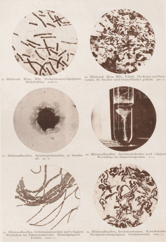 Six microscope images of the anthrax bacterium, page, photomechanical print, number: 'Tafel IV.', inscription: '19. Milzbrand. Maus. Milz. Deckglasausstrichpräparat. Methylenblau. 1000:1. 20. Milzbrand. Maus. Milz. Die Kerne mit Pocrocarmin, die Bacillien nach Gram-Günther gefärbt. 500:1. 21. Milzbrand bacilli. Gelatinplattencultur, 48 Stunden alt. 40:1. 22. Milzbrand bacilli. Gelatin stick culture after 7 days of waiting time at Zimmertemepratur. 1:1. 23. Milzbrand bacilli. Gelatin plate culture after 1 day of waiting time at Zimmertemperatur. Klatschpräparat. Fuchsin. 1000:1. 24. Milzbrand bacilli, Involutionsformen. Kartoffelculture. Deckglassrockenpräparat. Gentianaviolett. 1000:1.', photographer: Carl Günther, Berlin, maker: Friedrich Julius Klinkhardt, Leipzig, c. 1880 - in or before 1890, Saxony, paper, collotype, photoprint, height 242 mm x width 165 mm, Prints in section at the back., unicellular animals, bacteria, bacilli, A vertically oriented aged paper sheet shows a grid o...