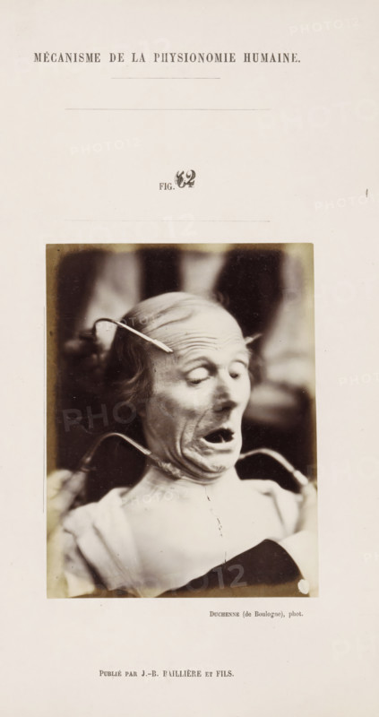 Test Subject undergoing Electrostimulation, photograph, page, Unnumbered page with photo 62 from Mécanisme de la physionomie humaine ou analyze électro-physiologique de l'expression des passions (Atlas)., photographer: Guillaume Benjamin Amand Duchenne, France, publisher: JB Baillière et Fils, Paris, 1876, Guillaume Benjamin Amand Duchenne, JB Baillière et Fils, photographer, publisher, paper, albumen print, albumendruk, height 119 mm x width 91 mm, experiment, test, science and technology, old man, face, morphology of facial expression, physiology and anatomy, physiognomy, nervous system, neurology, A sepia-toned portrait photograph mounted on a pale page showing an older person with a gaunt face and thinning hair, eyes closed and mouth open in an exaggerated expression, with metal hooks or instruments touching the temples and jawline, the neck and shoulders visible beneath a light garment, and the background softly blurred.