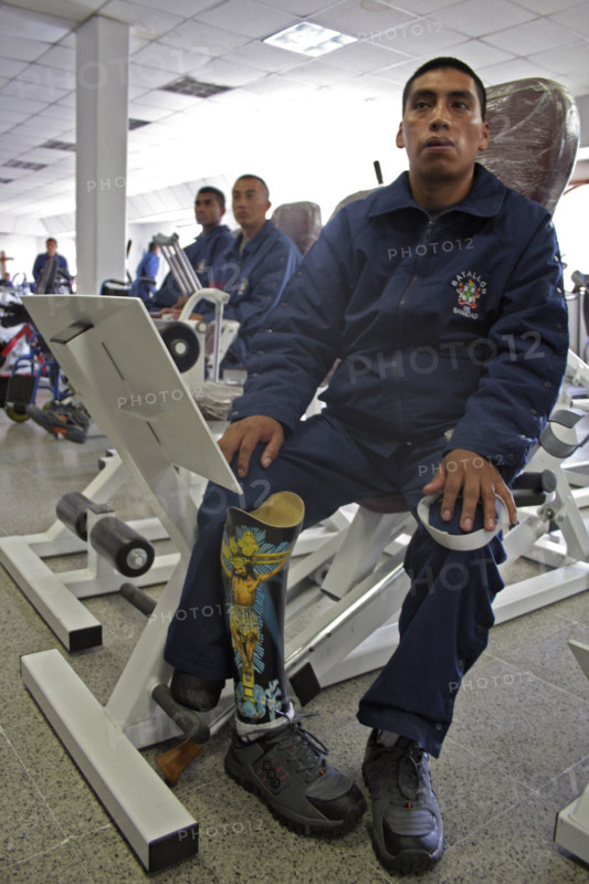 Injured Soldier In Bogota
