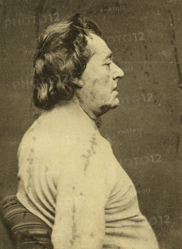 Frédéric Lemaître