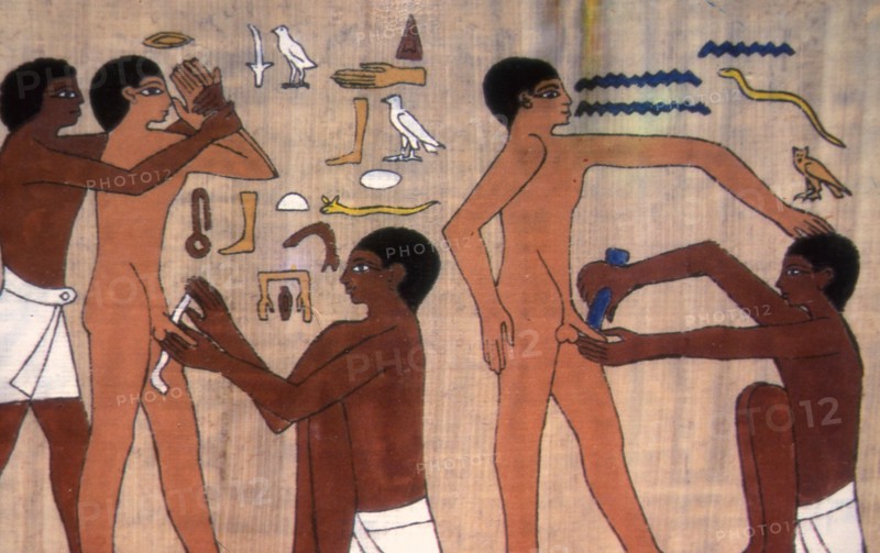 Pharaonic circumcision, Egypt