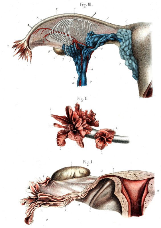 Trompe de FALLOPE
