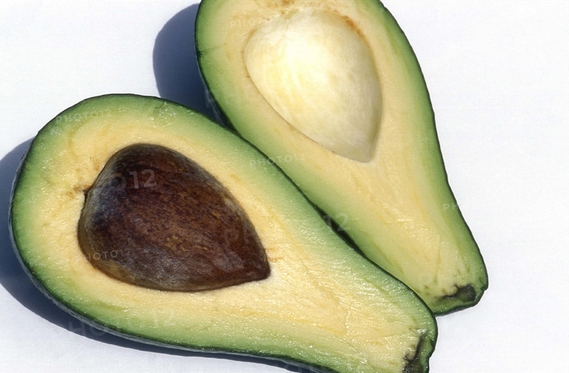 Avocat