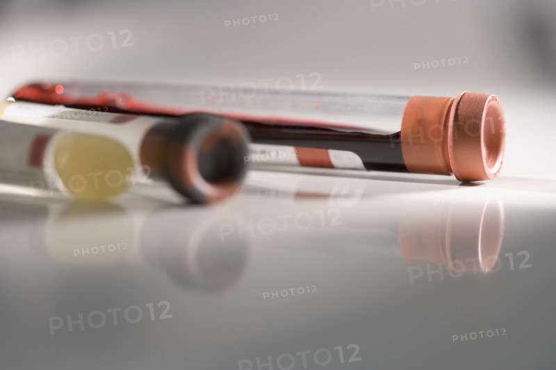 Closeup of blood samples in tubes.