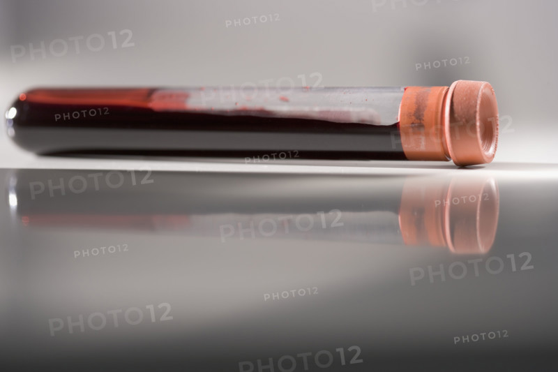 Closeup of blood sample in tube.