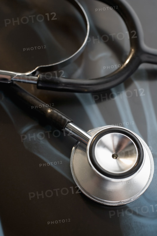 Close up of stethoscope on x-ray.