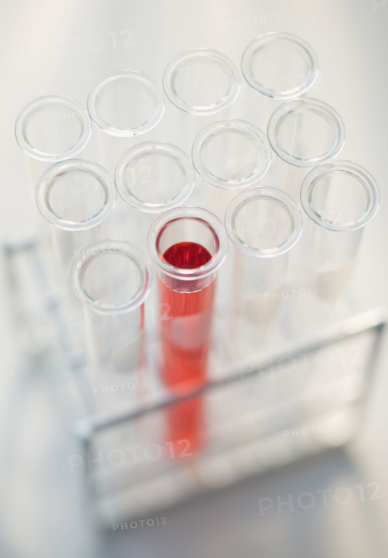 Close up of vials in tray .