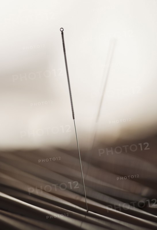 Close up of acupuncture needle.