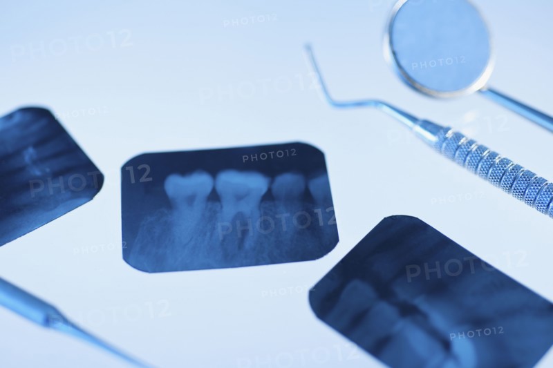 Dental instruments and x-rays.