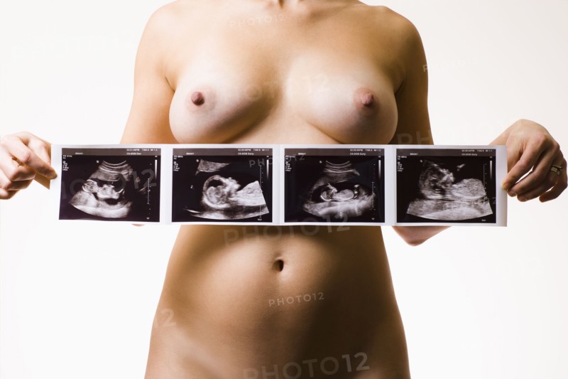 Studio shot of naked pregnant woman holding ultrasonography picture. Photo : Noah Clayton