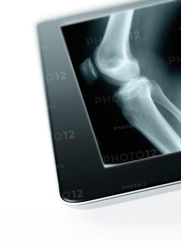 Studio shot of digital tablet with x-ray of human knee. Photo: David Arky