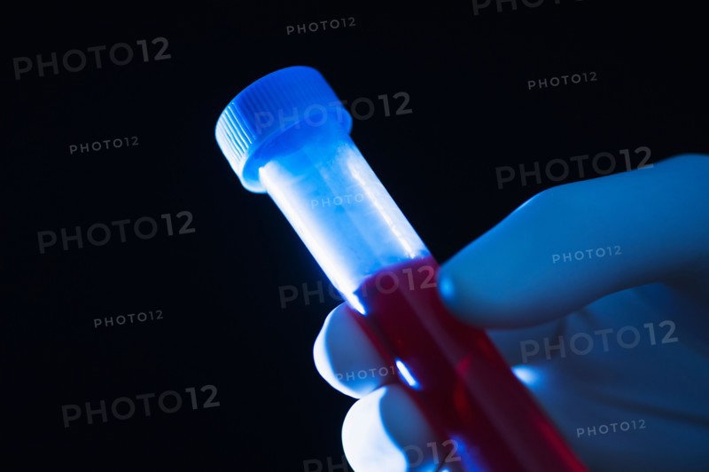 Studio shot of hand holding vial with blood.