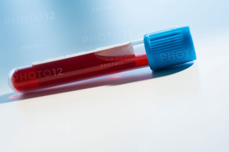Studio shot of blood sample.