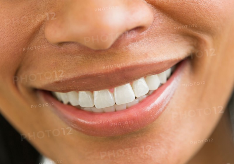 Close-up of woman's perfect teeth.