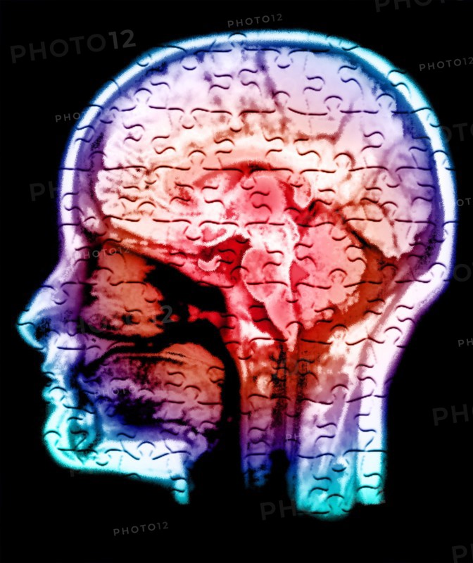 Conceptual image of human brain. 
Photo: Calysta Images