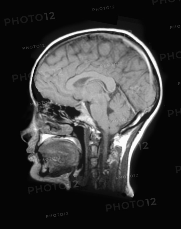 MRI Scan of human head. 
Photo: Calysta Images