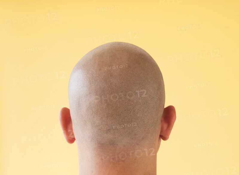 Studio shot of man's shaved head.