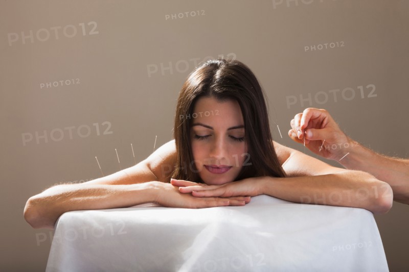 Close-up of woman with acupuncture needles in her arm and shoulders. Photo: Mike Kemp
