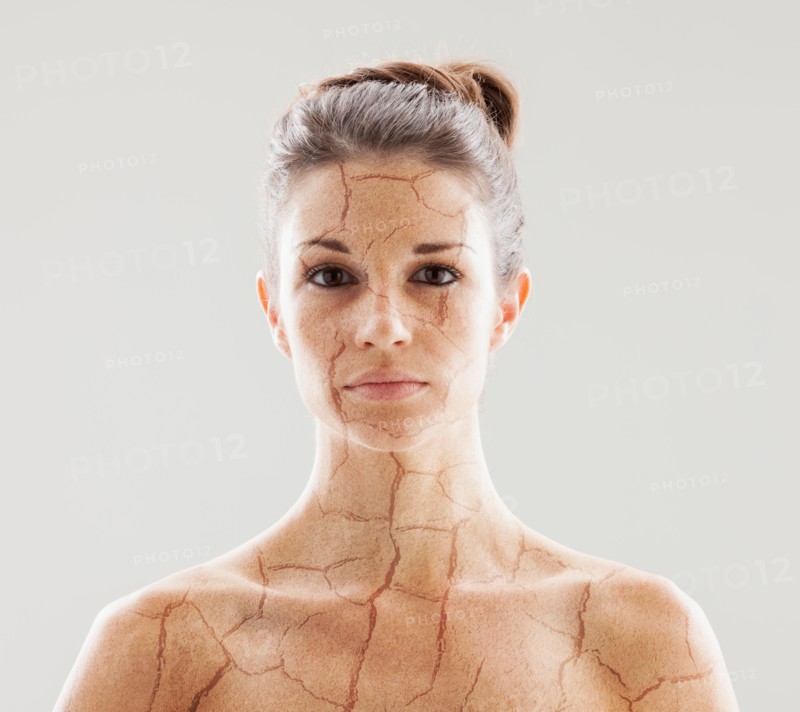 Head and shoulders shot of woman with cracked skin. Photo : Mike Kemp