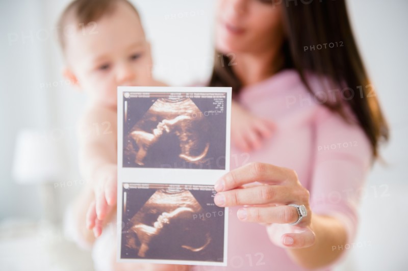 Mother with daughter (6-11 months) holding ultrasound scan