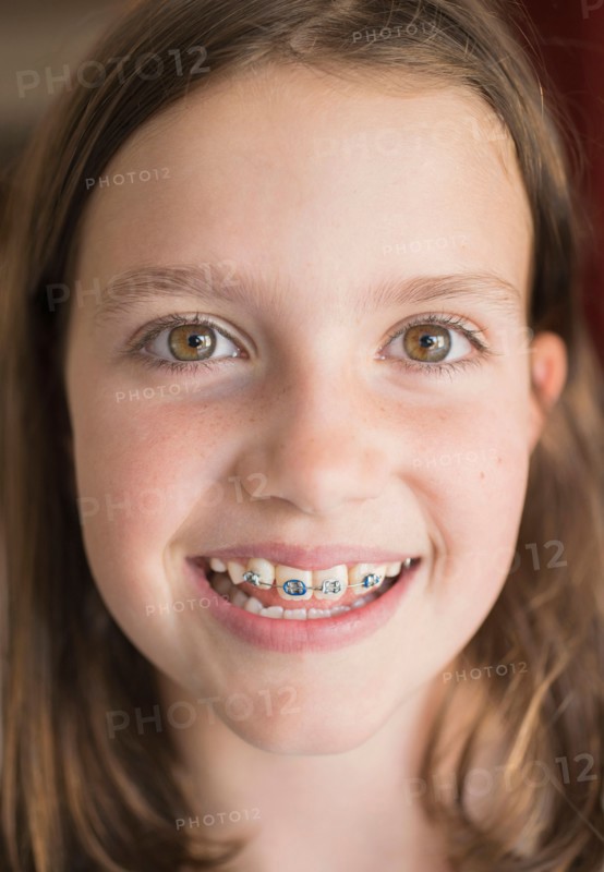 Girl (8-9) showing braces.