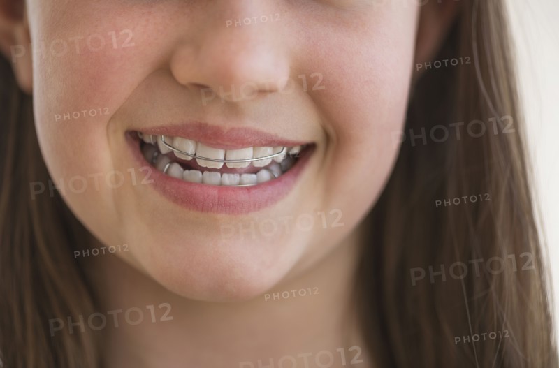 girl (10-11) wearing dental braces smiling.