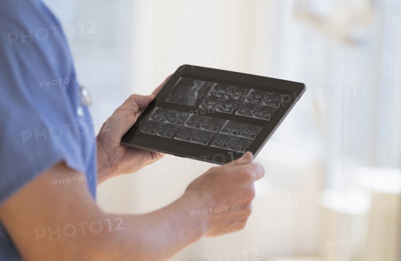 Man in scrubs watching ultrasound results on tablet.