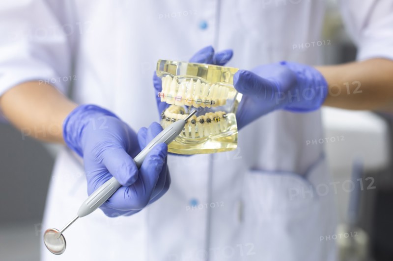 Dental assistant holding model teeth with braces