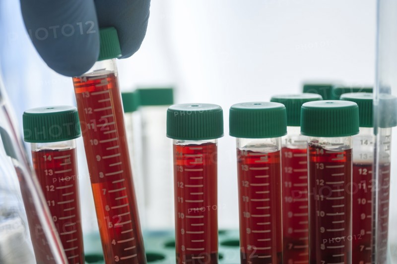 Vials of blood in lab