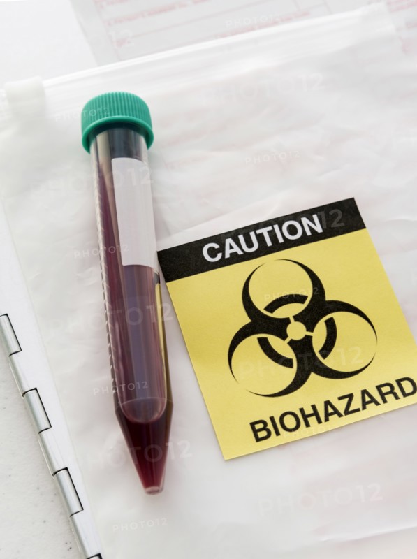 Blood sample with biohazard sign