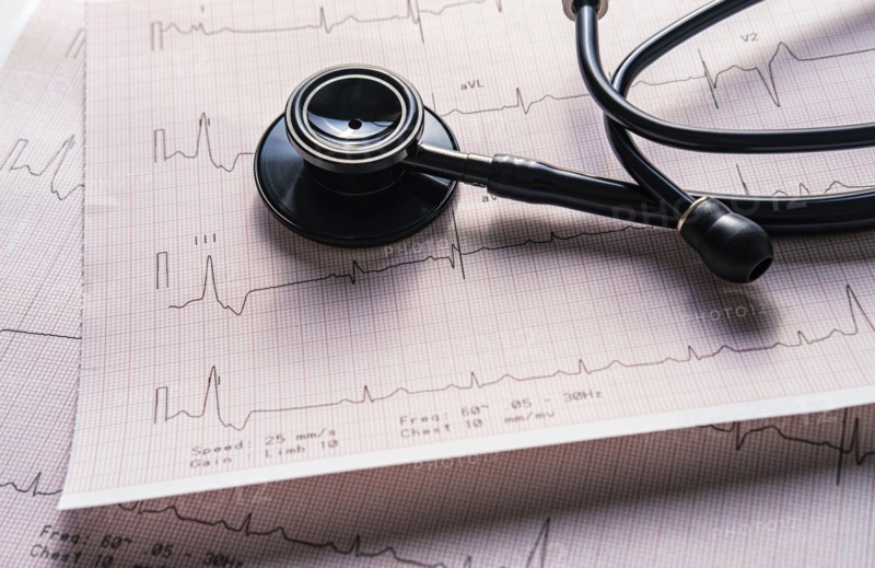 Stethoscope on electrocardiogram